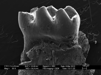  Tooth 